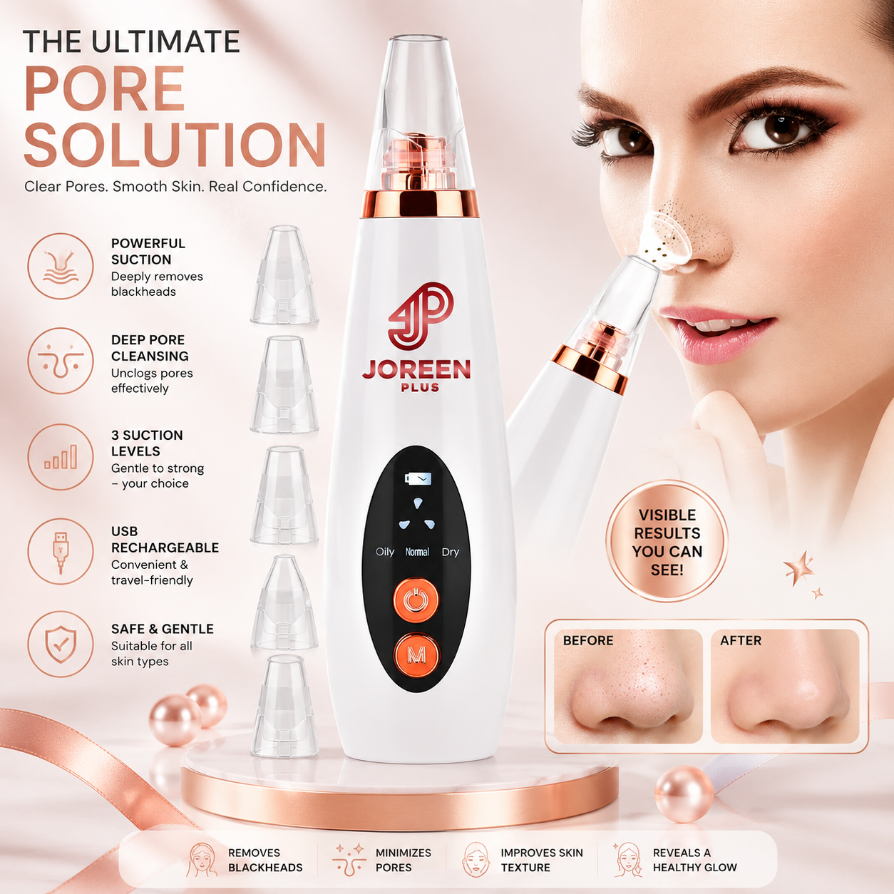 5-in-1 Electric Blackhead Remover & Pore Vacuum